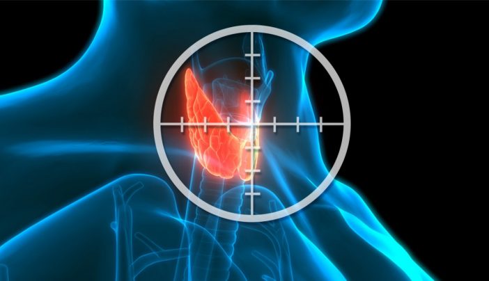 how-is-medullary-thyroid-cancer-treated-md-anderson-cancer-center