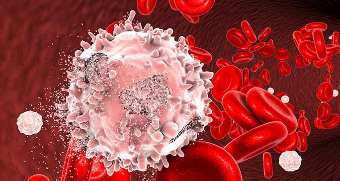 Illustration of a leukemia cell in the blood