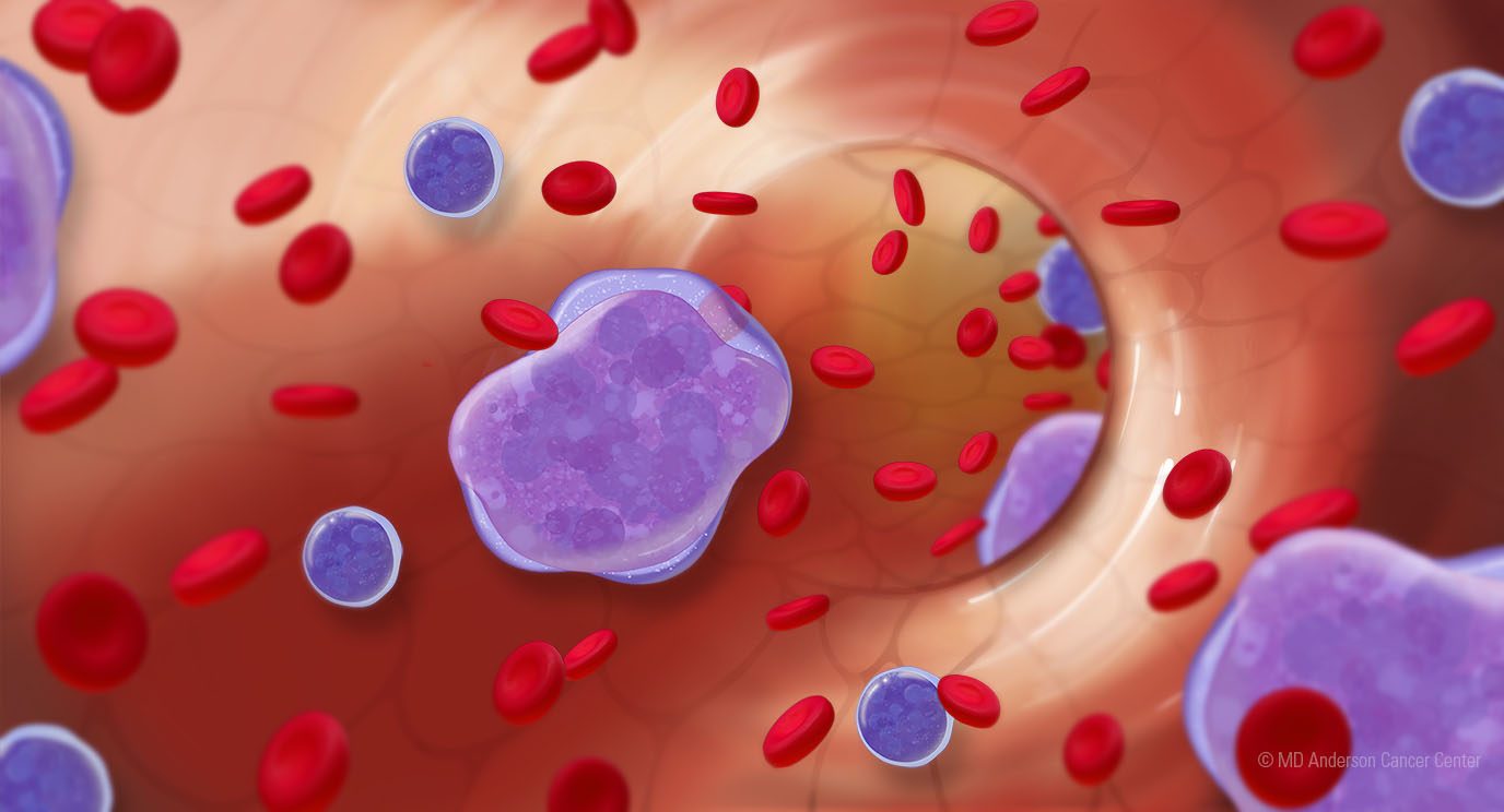 A typical B cell and an affected B cell from Richter transformation.