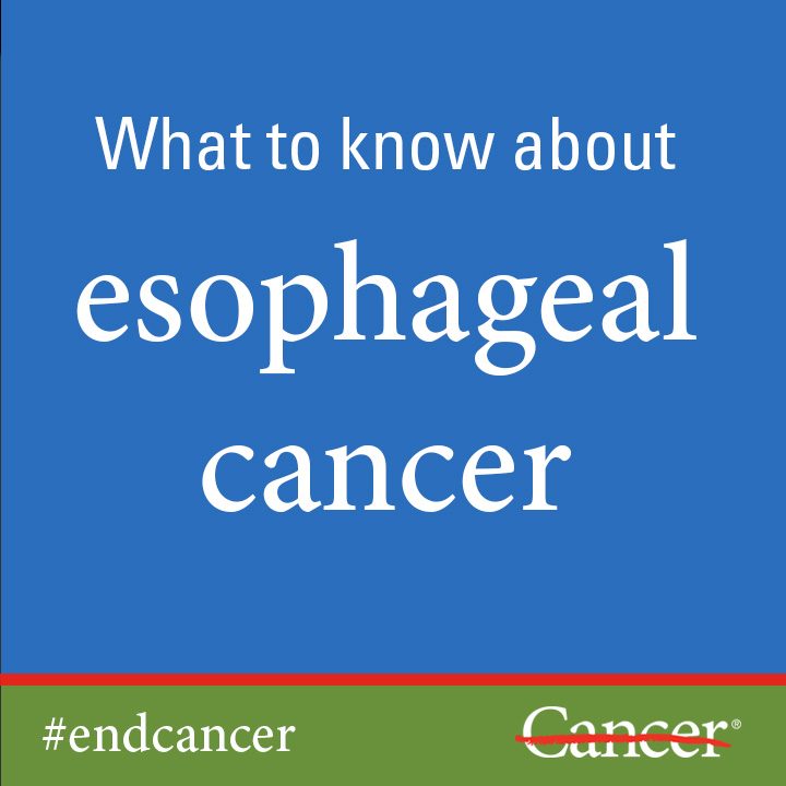 Learn about esophageal cancer diagnosis and esophageal cancer treatment.