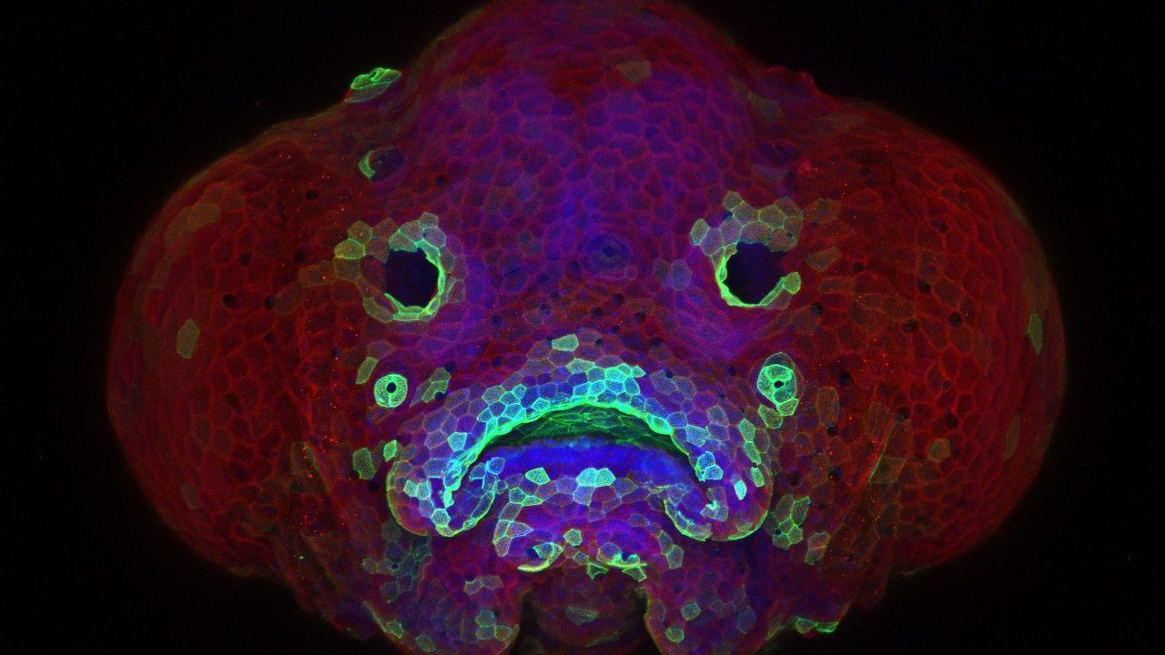 Cancerwise blog post: Zebrafish photo wins photography contest