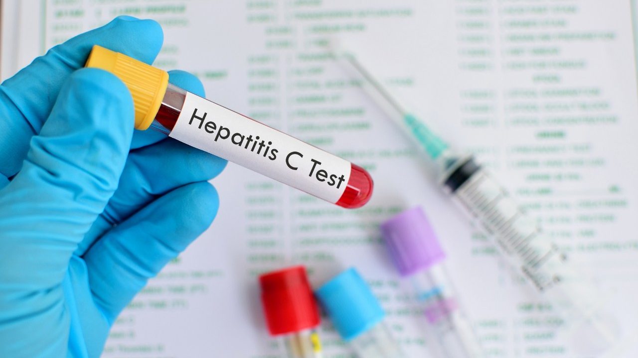 Photo of a hepatitis C test. Hepatitis C is linked to several cancers, including liver cancer, non-Hodgkin's lymphoma, bile duct cancer and possibly pancreatic and head and neck cancers.