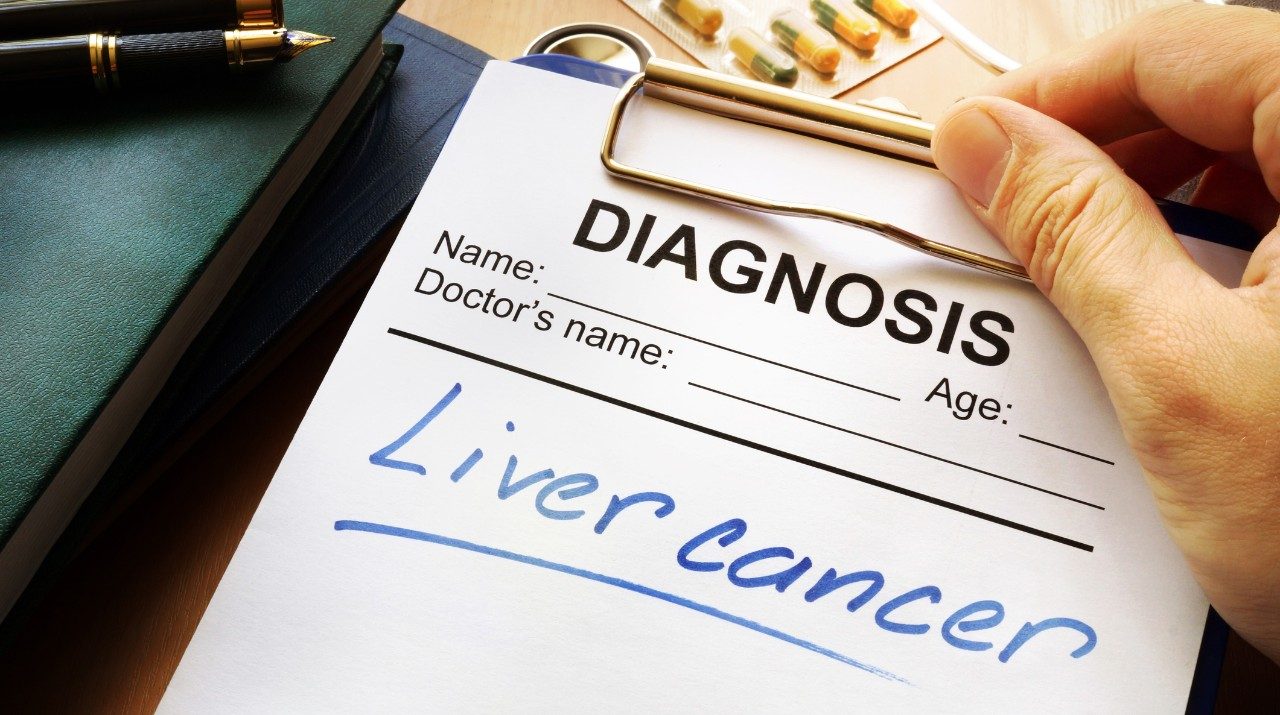 "Liver cancer" written on diagnosis paper