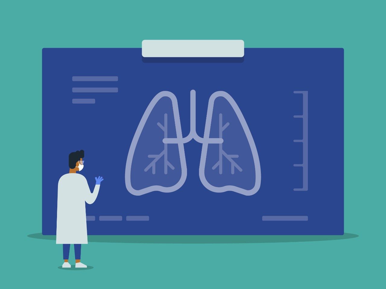 Graphic of masked doctor looking at lung cancer scan