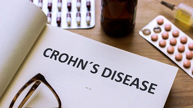 open notebook that says Crohn's disease, wtih pills and glasses