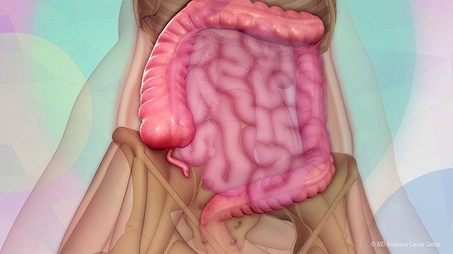 Medical illustration showing the intestines and appendix