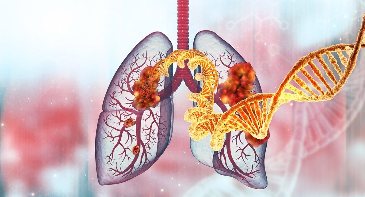 Illustration of a DNA strand emerging from a set of lungs