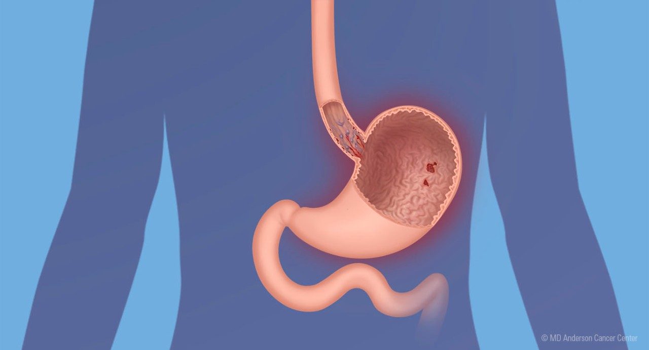 Anatomical illustration of esophagus and stomach