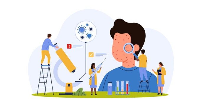 Graphic of boy with red spots on face surrounded by people with a microscope, clipboard, vaccine, microscope and virus particles. 