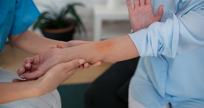 Doctor looks at a rash on a woman's arm