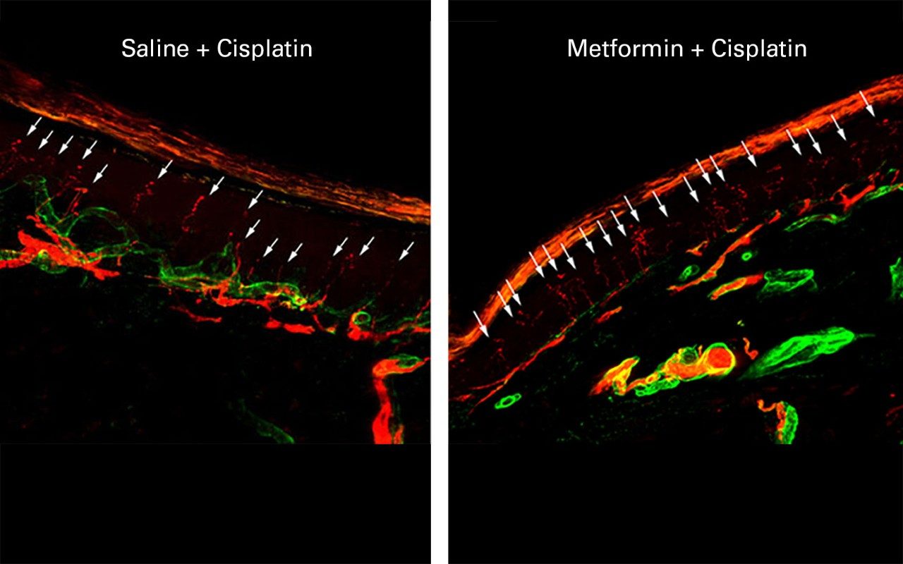 metformin protects against chemotherapy-induced peripheral neuropathy (CIPN)