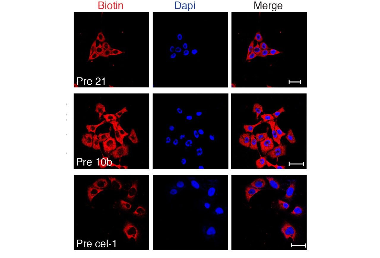 exosomes