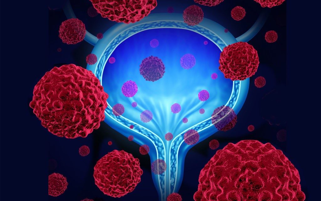 bladder cancer combination immunotherapy treatment clinical trial