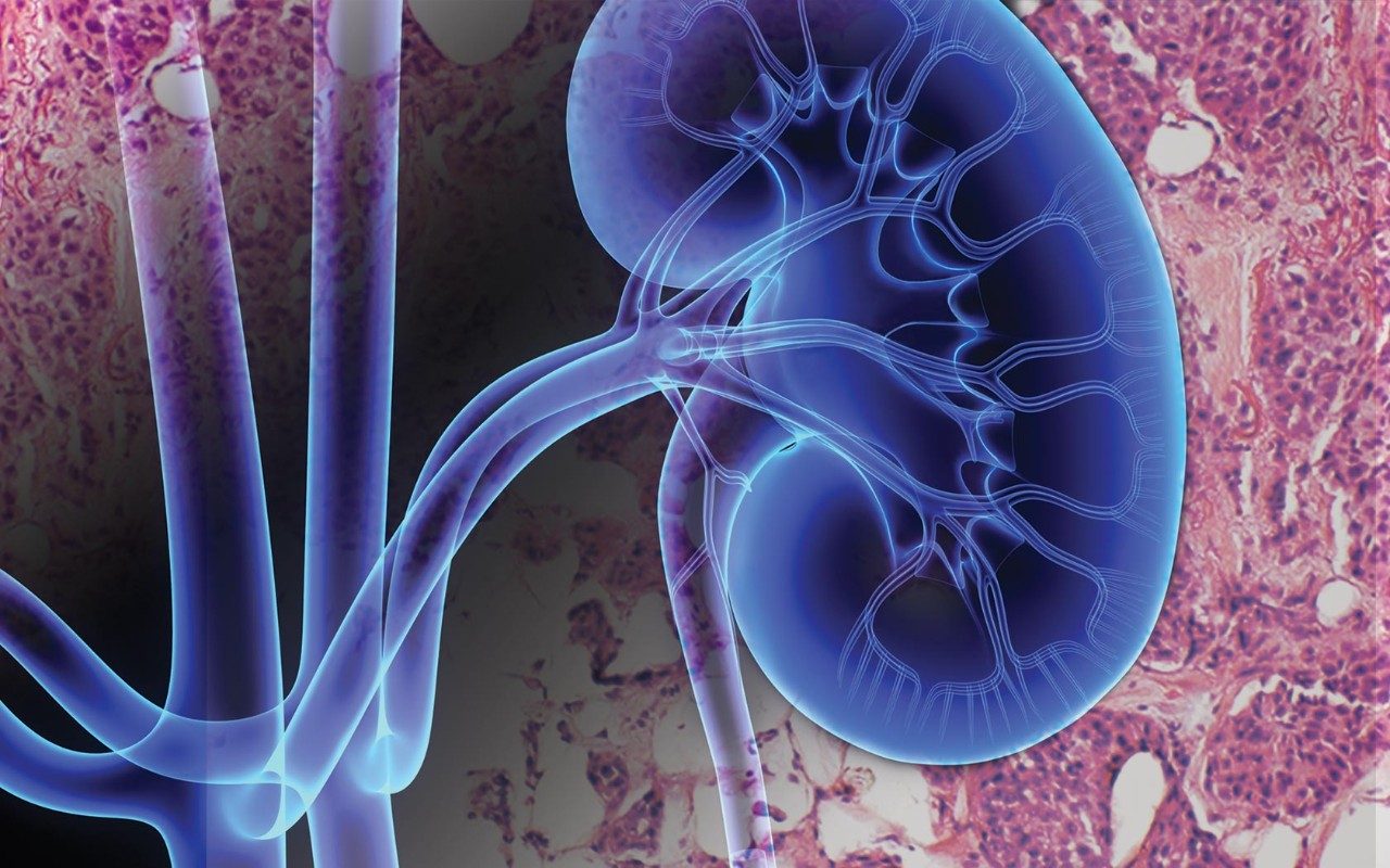 combination immunotherapy for kidney cancer