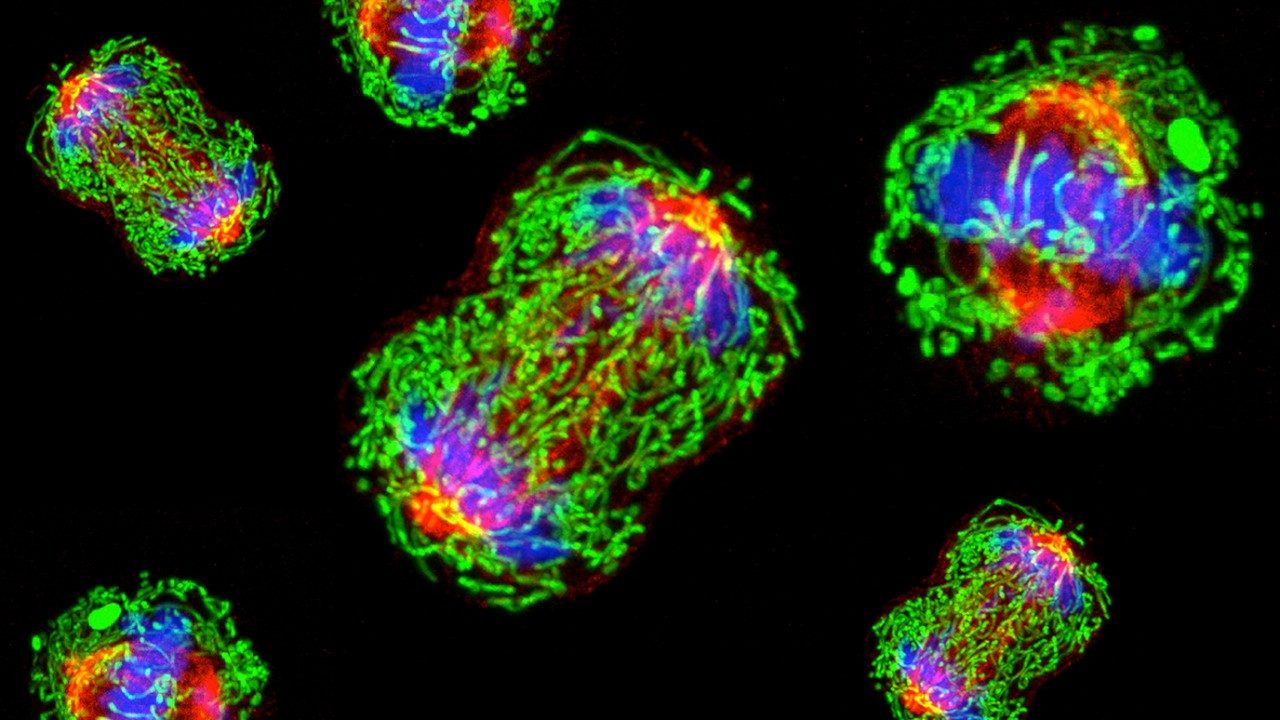 triple-negative breast cancer cells in metaphase during cell division