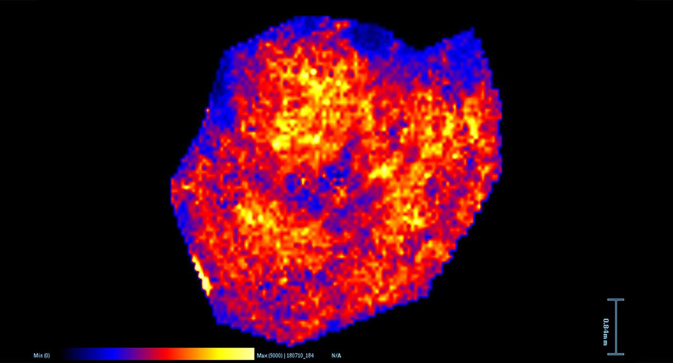 Imaging mass spectrometry showing increased abundance of ATP, a cellular energy compound, in the omentum of mice after injection with omentin protein. 