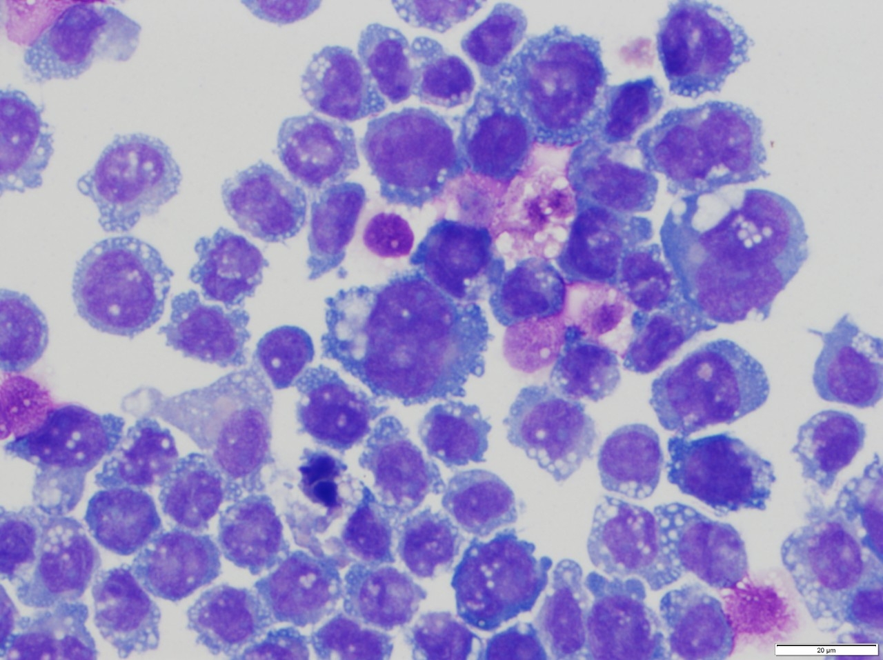 Hematopathology