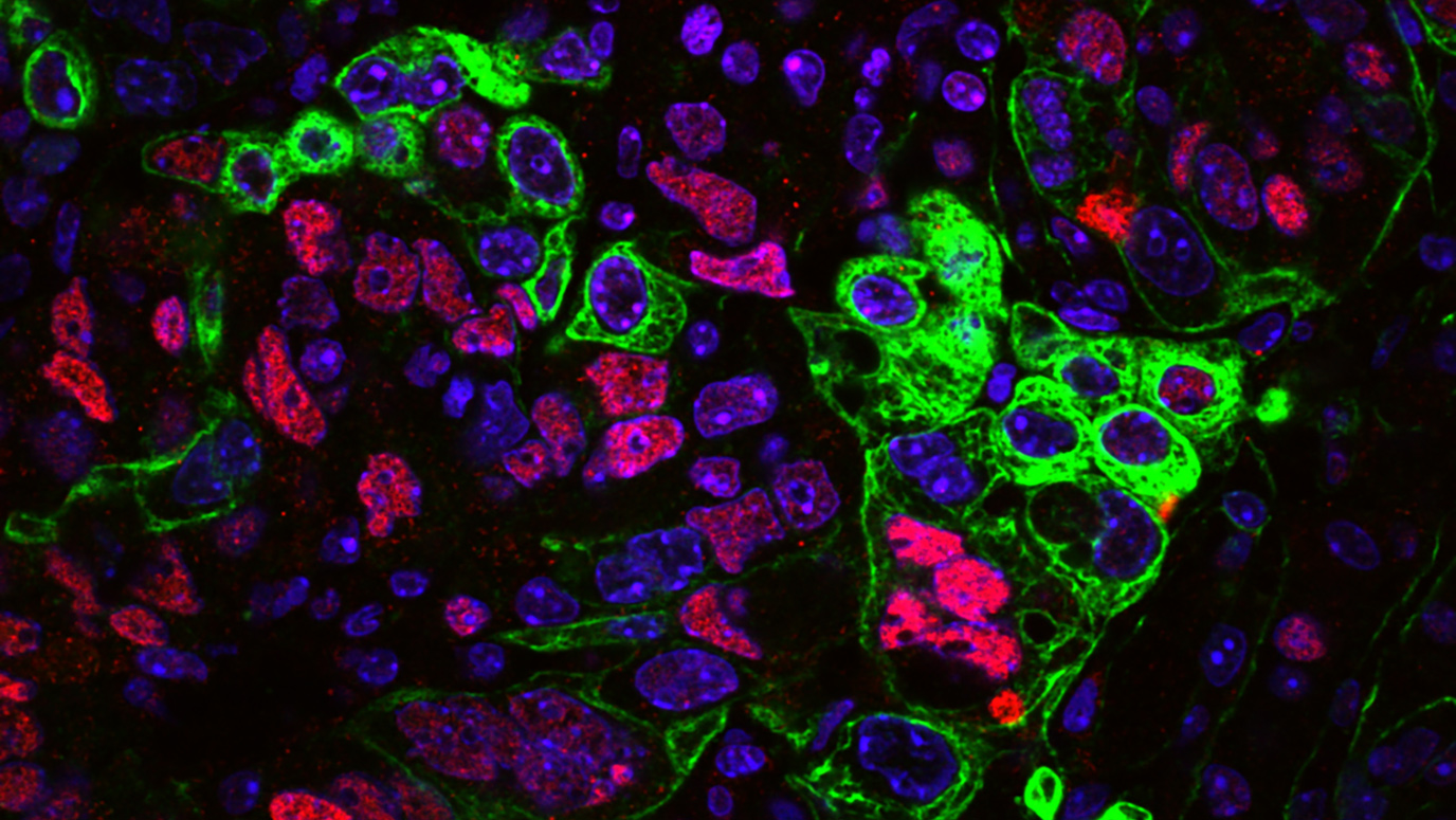 A novel CRISPR engineering approach, understanding immunotherapy ...